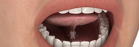 Пластика уздечки губы или языка. Когда и как проводятся. Вопросы к врачу.