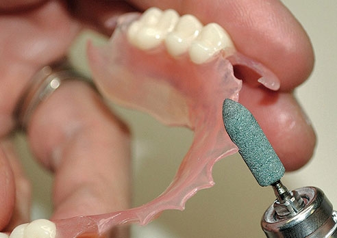 Коррекция зубных протезов